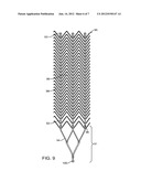 SYSTEM AND METHOD FOR TREATING ISCHEMIC STROKE diagram and image