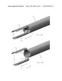 BIPOLAR MEDICAL DEVICES FOR EXTRACTING TISSUE AND METHODS THEREFOR diagram and image