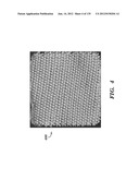 IMPLANTABLE SILK PROSTHETIC DEVICE AND USES THEREOF diagram and image