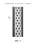 IMPLANTABLE SILK PROSTHETIC DEVICE AND USES THEREOF diagram and image