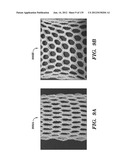 IMPLANTABLE SILK PROSTHETIC DEVICE AND USES THEREOF diagram and image