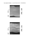 IMPLANTABLE SILK PROSTHETIC DEVICE AND USES THEREOF diagram and image