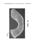 IMPLANTABLE SILK PROSTHETIC DEVICE AND USES THEREOF diagram and image