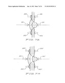 MEDICAL DEVICE FOR OCCLUDING A HEART DEFECT AND A METHOD OF MANUFACTURING     THE SAME diagram and image