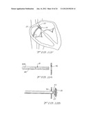 MEDICAL DEVICE FOR OCCLUDING A HEART DEFECT AND A METHOD OF MANUFACTURING     THE SAME diagram and image