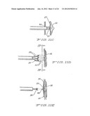 MEDICAL DEVICE FOR OCCLUDING A HEART DEFECT AND A METHOD OF MANUFACTURING     THE SAME diagram and image