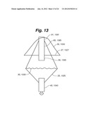 MEDICAL DEVICE FOR OCCLUDING A HEART DEFECT AND A METHOD OF MANUFACTURING     THE SAME diagram and image