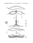 MEDICAL DEVICE FOR OCCLUDING A HEART DEFECT AND A METHOD OF MANUFACTURING     THE SAME diagram and image