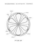 MEDICAL DEVICE FOR OCCLUDING A HEART DEFECT AND A METHOD OF MANUFACTURING     THE SAME diagram and image