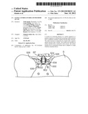 SACRAL TETHER ANCHOR AND METHODS OF USE diagram and image