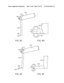 SACRAL TETHER ANCHOR AND METHODS OF USE diagram and image