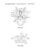 SACRAL TETHER ANCHOR AND METHODS OF USE diagram and image