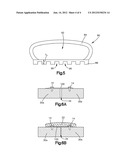 METHOD OF FIXATING TWO OR MORE ANATOMICAL BODIES diagram and image