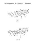 Flexible Circuit Electrode Array Device and a Method for Backside     Processing of a Flexible Circuit Electrode Device diagram and image