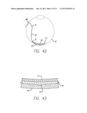 Flexible Circuit Electrode Array Device and a Method for Backside     Processing of a Flexible Circuit Electrode Device diagram and image
