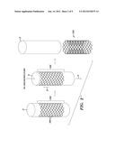 STENTS AND METHODS OF MAKING STENTS diagram and image