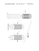 STENTS AND METHODS OF MAKING STENTS diagram and image