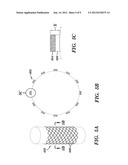 STENTS AND METHODS OF MAKING STENTS diagram and image