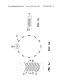 STENTS AND METHODS OF MAKING STENTS diagram and image