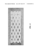 STENTS AND METHODS OF MAKING STENTS diagram and image