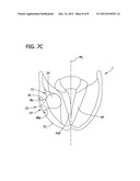 LARYNGEAL IMPLANT FOR TREATING GLOTTIC INSUFFICIENCY diagram and image