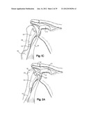 SOFT TISSUE REPAIR APPARATUS AND METHOD diagram and image