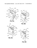 SOFT TISSUE REPAIR APPARATUS AND METHOD diagram and image