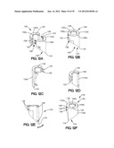 SOFT TISSUE REPAIR APPARATUS AND METHOD diagram and image