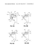 SOFT TISSUE REPAIR APPARATUS AND METHOD diagram and image