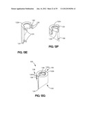 SOFT TISSUE REPAIR APPARATUS AND METHOD diagram and image