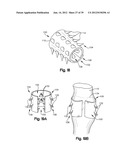 SOFT TISSUE REPAIR APPARATUS AND METHOD diagram and image