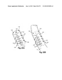 SOFT TISSUE REPAIR APPARATUS AND METHOD diagram and image