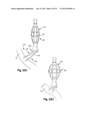 SOFT TISSUE REPAIR APPARATUS AND METHOD diagram and image