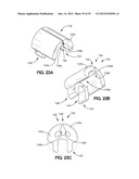 SOFT TISSUE REPAIR APPARATUS AND METHOD diagram and image