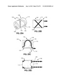 SOFT TISSUE REPAIR APPARATUS AND METHOD diagram and image