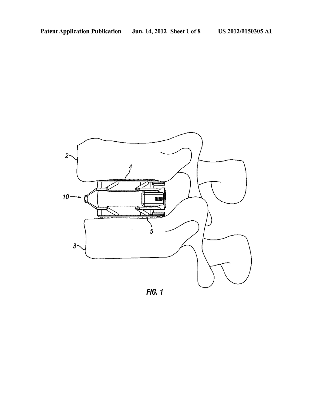 Expandable Fusion Device and Method of Installation Thereof - diagram, schematic, and image 02