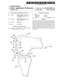 Pyrocarbon Orthopedic Implant diagram and image