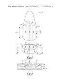 Pyrocarbon Orthopedic Implant diagram and image