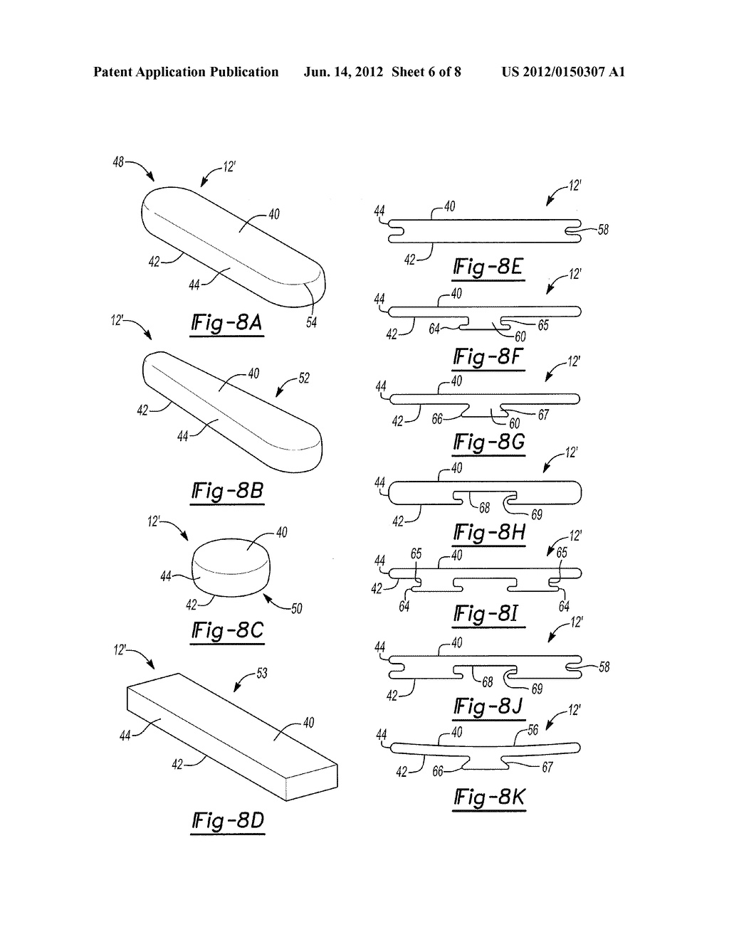 Pyrocarbon Orthopedic Implant - diagram, schematic, and image 07