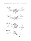 PROSTHETIC WRIST IMPLANT diagram and image