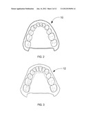 ORTHODONTIC ALIGNER FABRICATION BY OVERLAY METHOD diagram and image