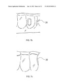 ORTHODONTIC ALIGNER FABRICATION BY OVERLAY METHOD diagram and image