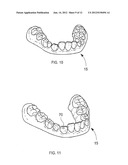 ORTHODONTIC ALIGNER FABRICATION BY OVERLAY METHOD diagram and image