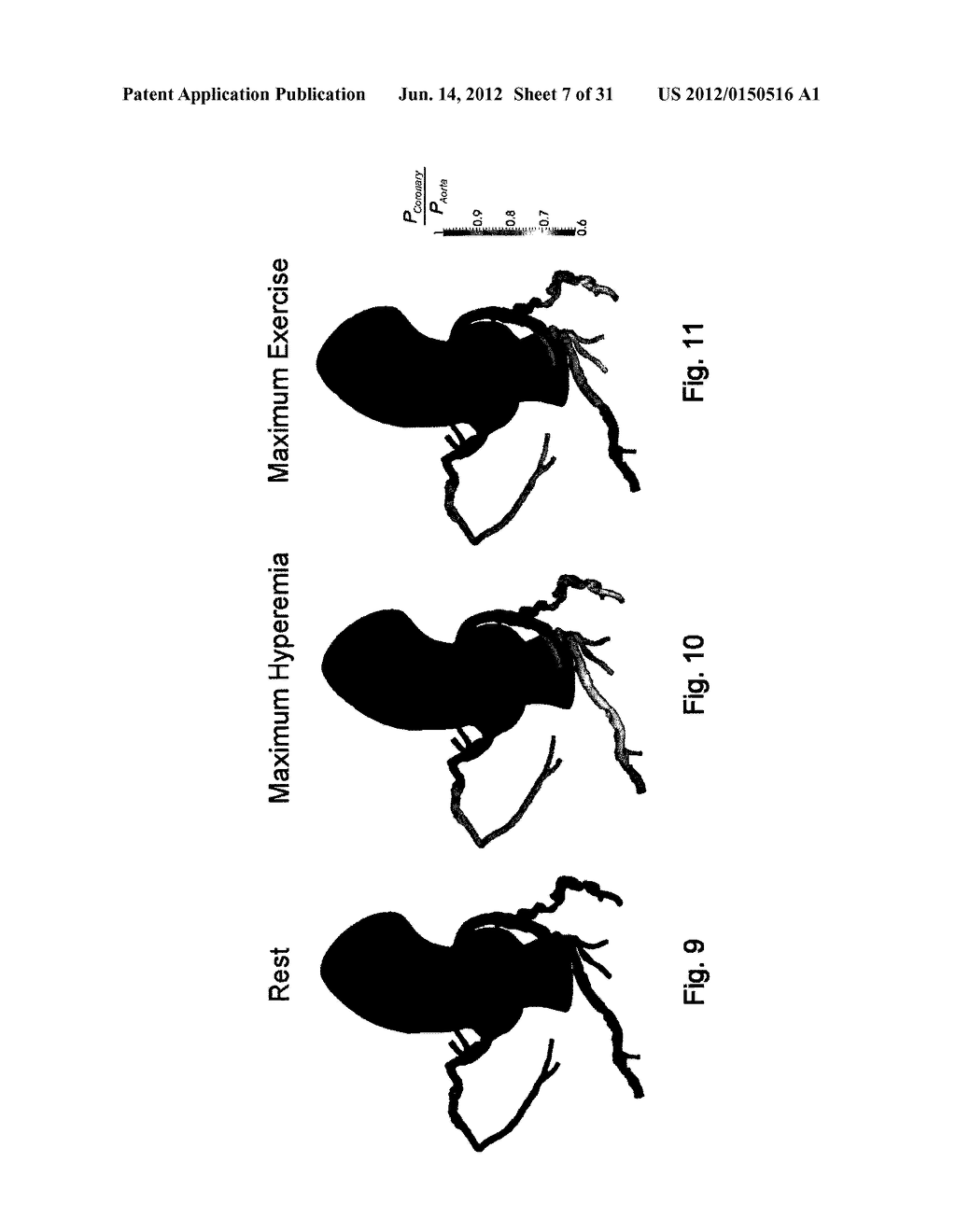 METHOD AND SYSTEM FOR PATIENT-SPECIFIC MODELING OF BLOOD FLOW - diagram, schematic, and image 08