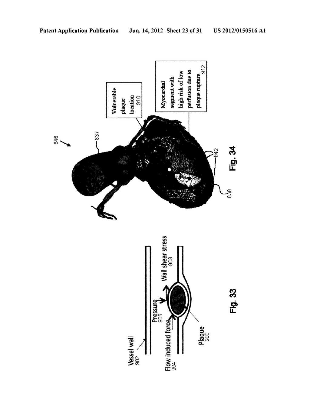 METHOD AND SYSTEM FOR PATIENT-SPECIFIC MODELING OF BLOOD FLOW - diagram, schematic, and image 24