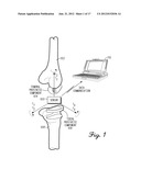 SHIELDED CAPACITOR SENSOR SYSTEM FOR MEDICAL APPLICATIONS AND METHOD diagram and image