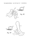 SHIELDED CAPACITOR SENSOR SYSTEM FOR MEDICAL APPLICATIONS AND METHOD diagram and image