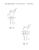 PARTICLE DISPERSION DEVICE FOR NASAL DELIVERY diagram and image