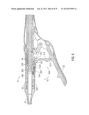 SURGICAL INSTRUMENT WITH SAFETY MECHANISM diagram and image