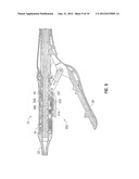 SURGICAL INSTRUMENT WITH SAFETY MECHANISM diagram and image